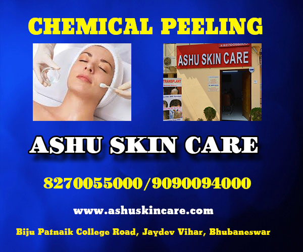 best chemical peeling clinic in bhubaneswar near ayush hospital - ashu skin care